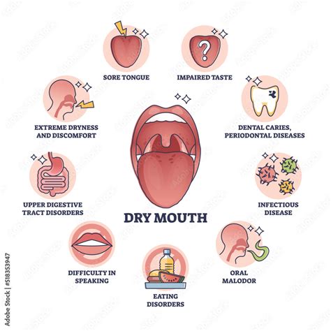 Symptoms of dry mouth