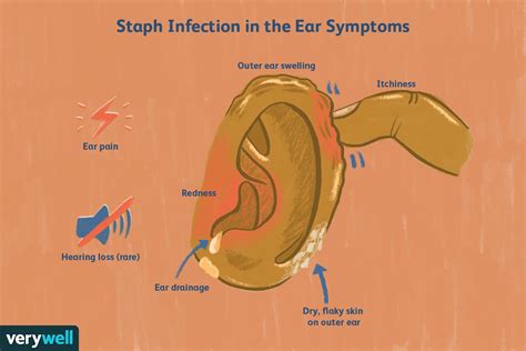 Description of Ear Infection