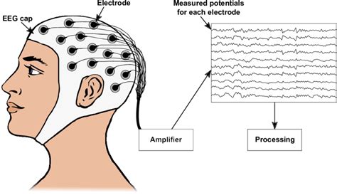 Description of EEG recording