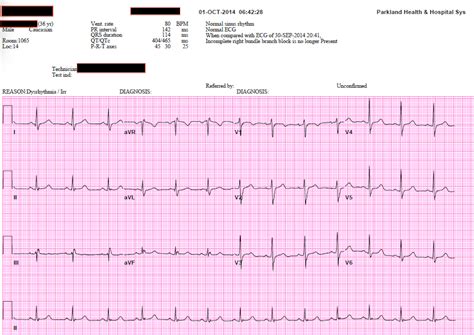 EKG Practice Strips for Nurses