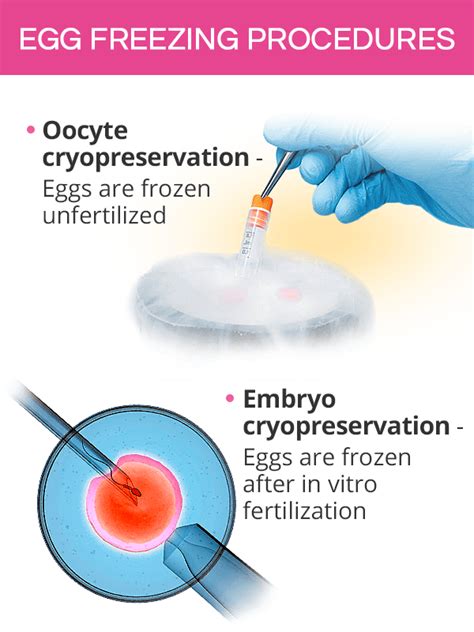 Description of Embryo Freezing Techniques