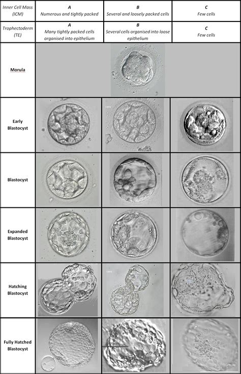 Description of Embryo Quality and Stage