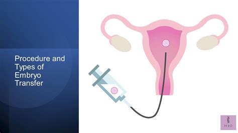 Description of Embryo Transfer Procedure