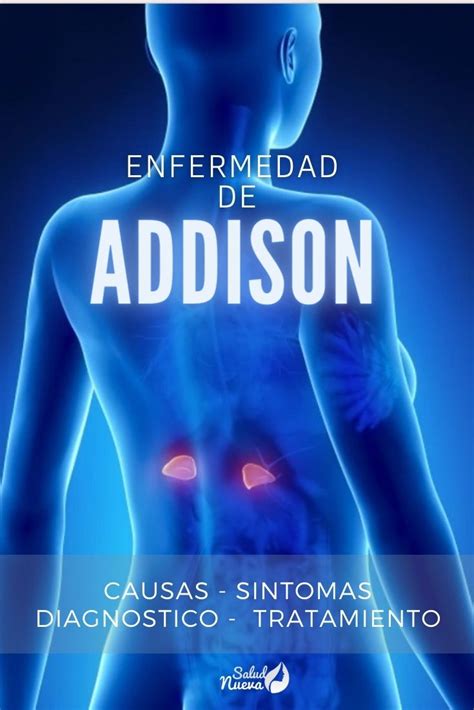 Imagen de un paciente con la enfermedad de Addison