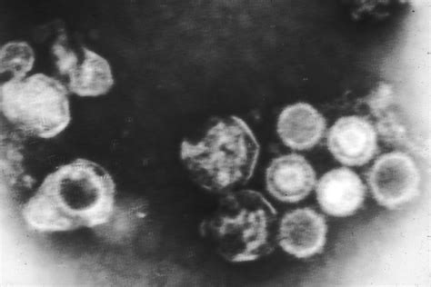 Description of Epstein-Barr Virus