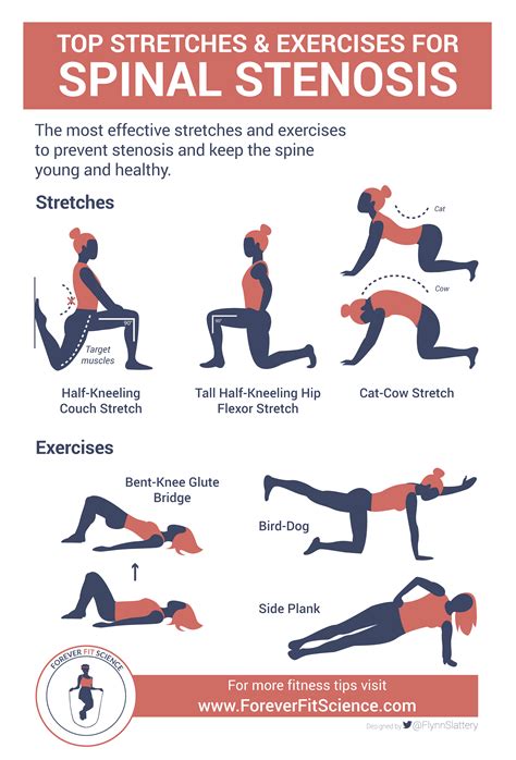 Exercises for Spinal Stenosis