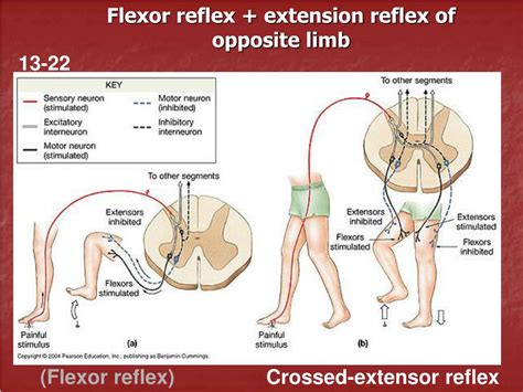 Extension Reflex in Newborns