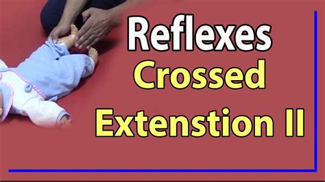 Extension Reflex