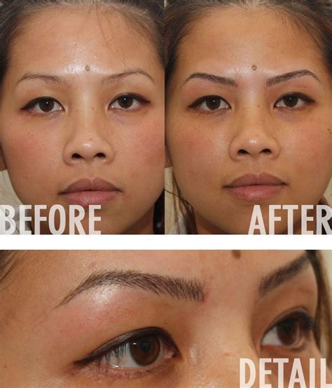 Eyebrow Tattoo Removal Methods