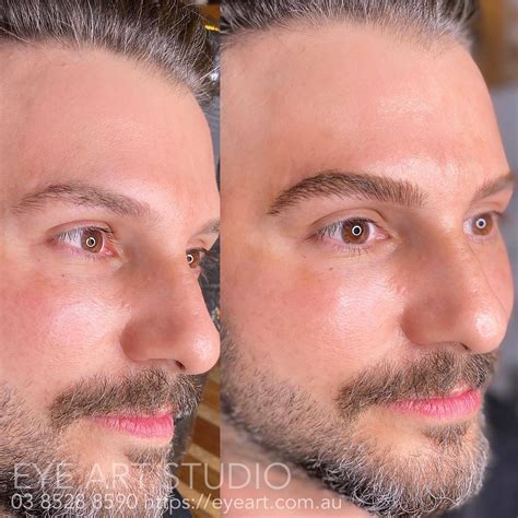 Eyebrow Tattooing for Men Before and After