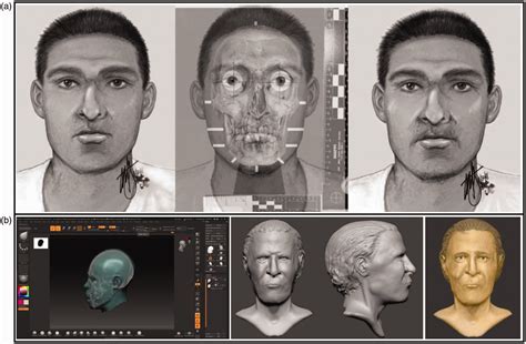 Description of Facial Reconstruction