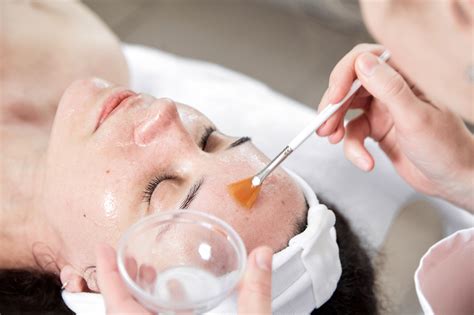 Facial Peels