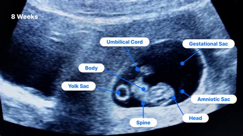 Fetal Ultrasound Examination