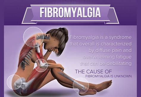 Fibromyalgia