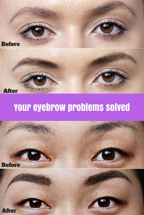 5 Ways to Fix Eyebrow Issues