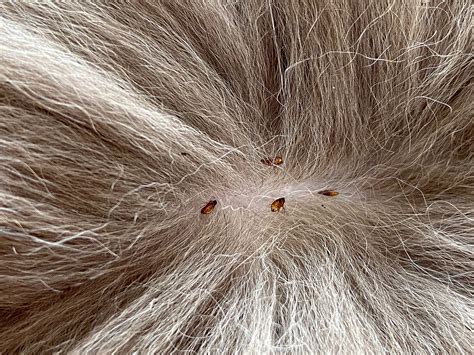 Flea infestation on human hair