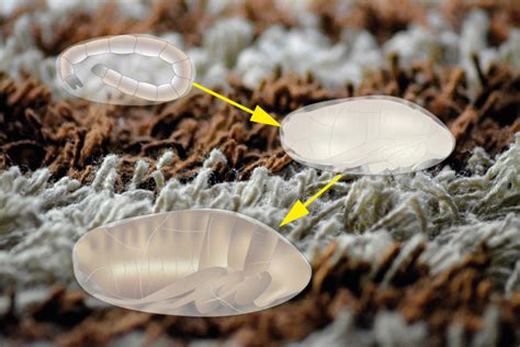 Flea pupae on human hair