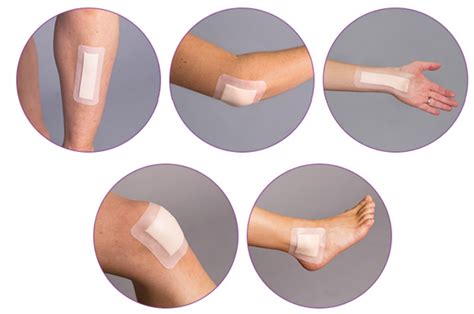 Foam dressings for wound care