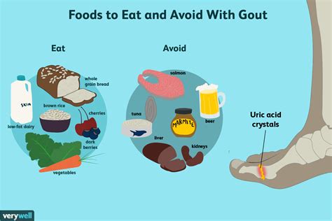 Food for gout