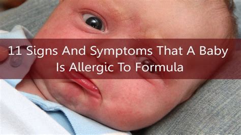 Formula allergy and intolerance