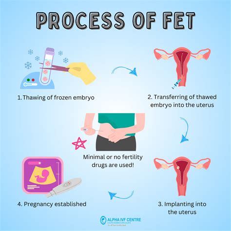 Description of Frozen Embryo Transfer Benefits