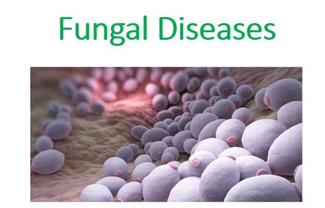 Description of Fungal Diseases