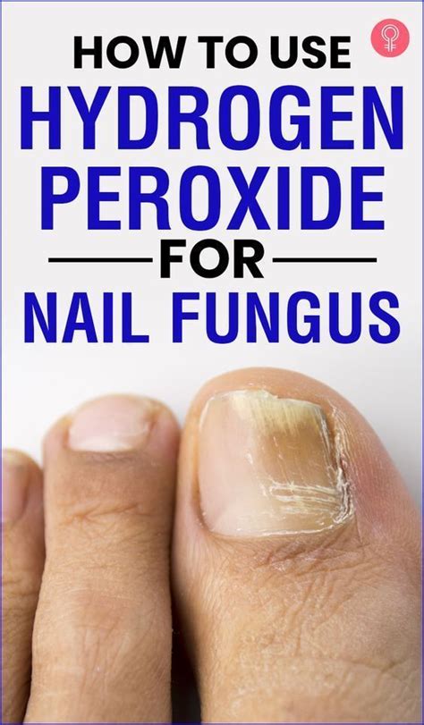 Fungus Peroxide Uses in Medicine