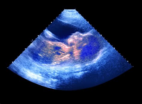 Sonographer using advanced ultrasound equipment