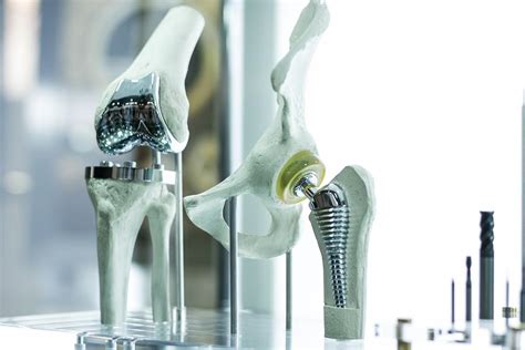 Future of Orthopedic Surgery