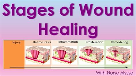 Gel for Wound Healing Process