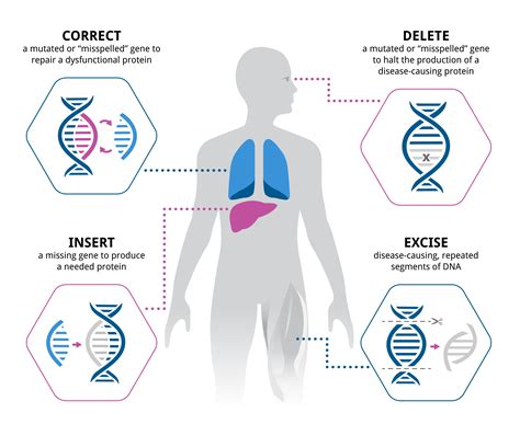 Gene Therapy