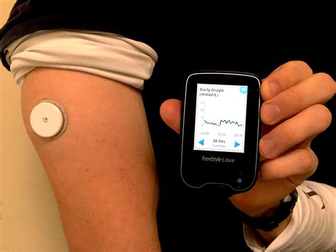 Glucose Monitoring System