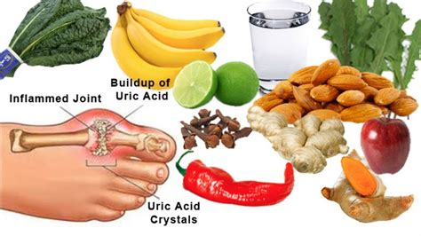 Gout relief foods