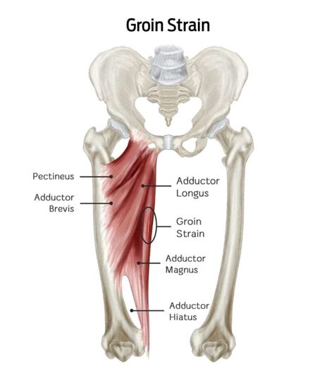 A diagram of groin muscle anatomy