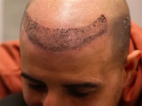 Hairline tattoo ideas for curly hair