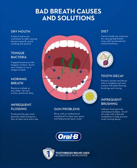 Halitosis causes and symptoms