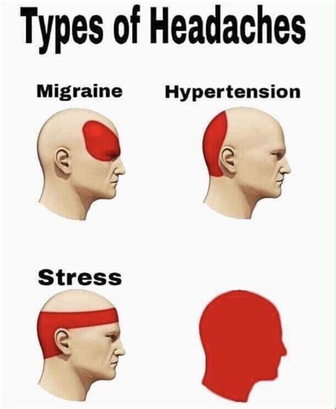 Funny headache meme template with a dog