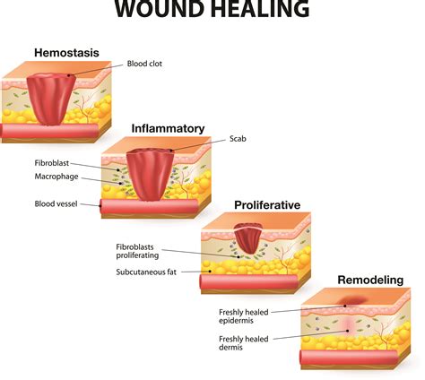 The journey towards healing