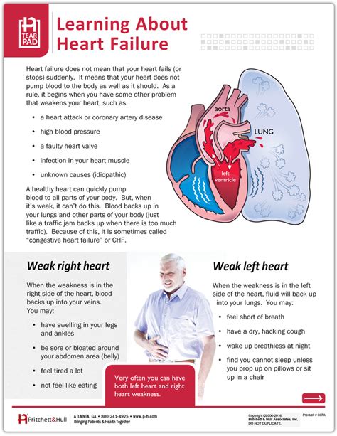 Heart Failure Education