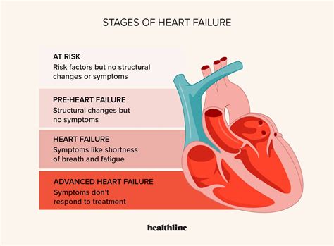 Heart Failure Stages