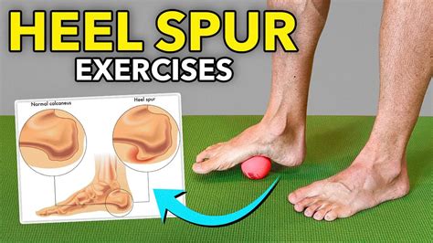 Heel Spur Prevention