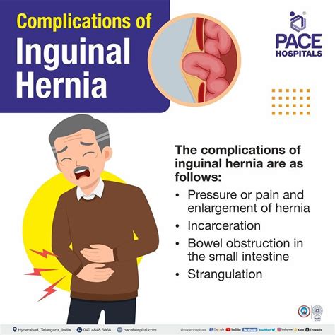 Complications of Hernias