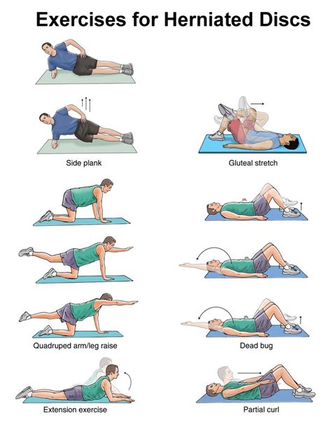 Herniated discs exercises