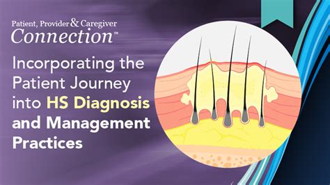 Description of Hidradenitis Management