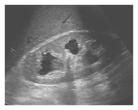 High-quality ultrasound images