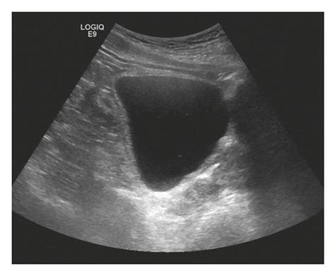 High-quality ultrasound images