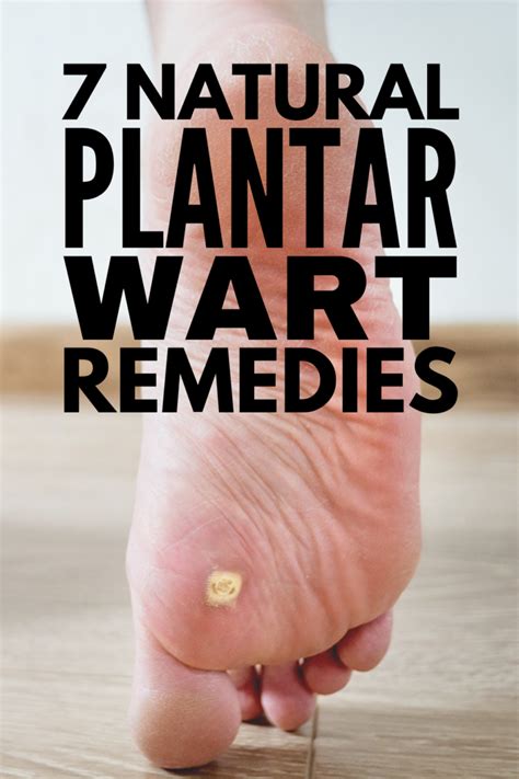 Home Remedies for Plantar Warts