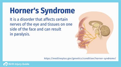 Causes of Horner's Syndrome in Dogs