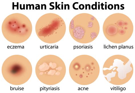 Human Skin Conditions 9