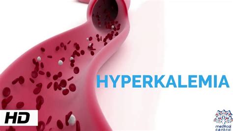 Hyperkalemia Awareness